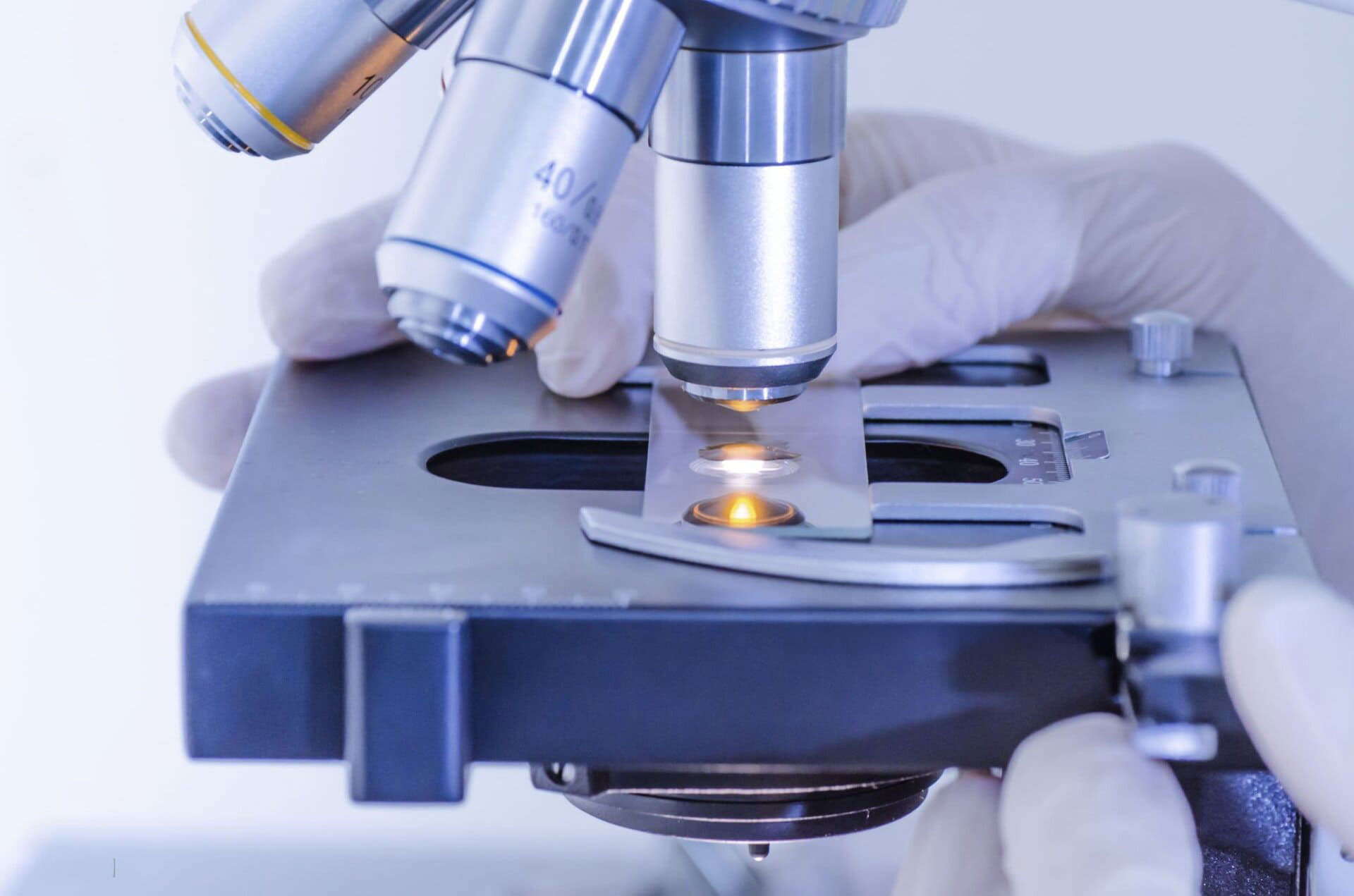 Biopsia de próstata — técnica quirúrgica