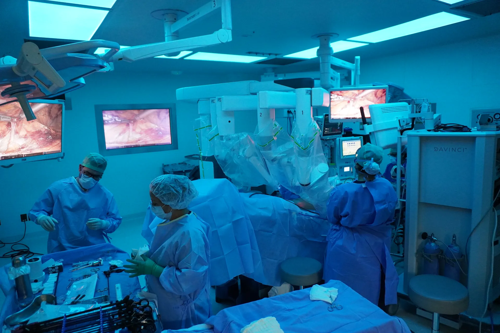 Cirugía robótica Da Vinci XI para prostatectomía radical