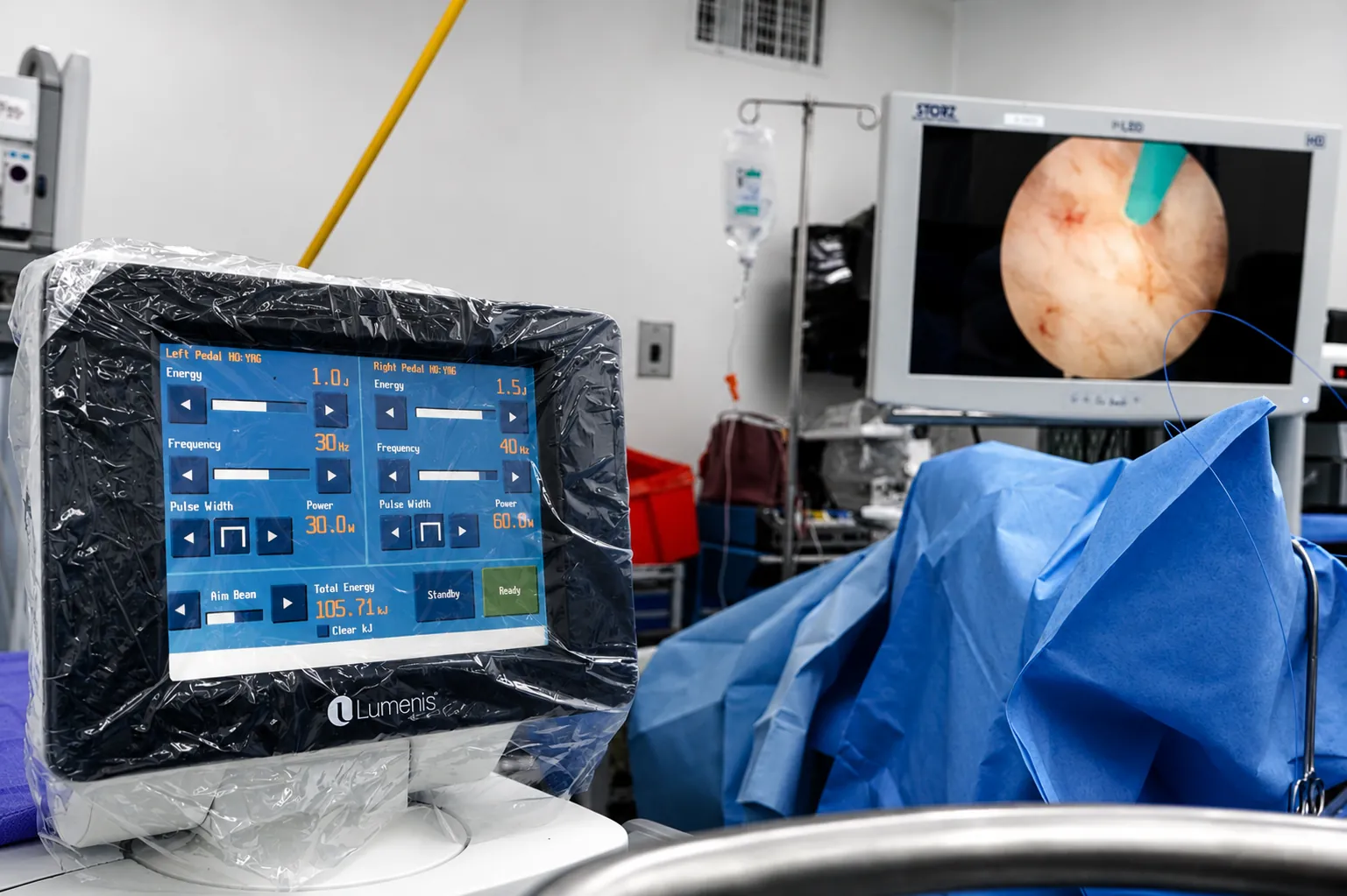 Consola del equipo láser y monitor endoscópico en el quirófano durante un HoLEP