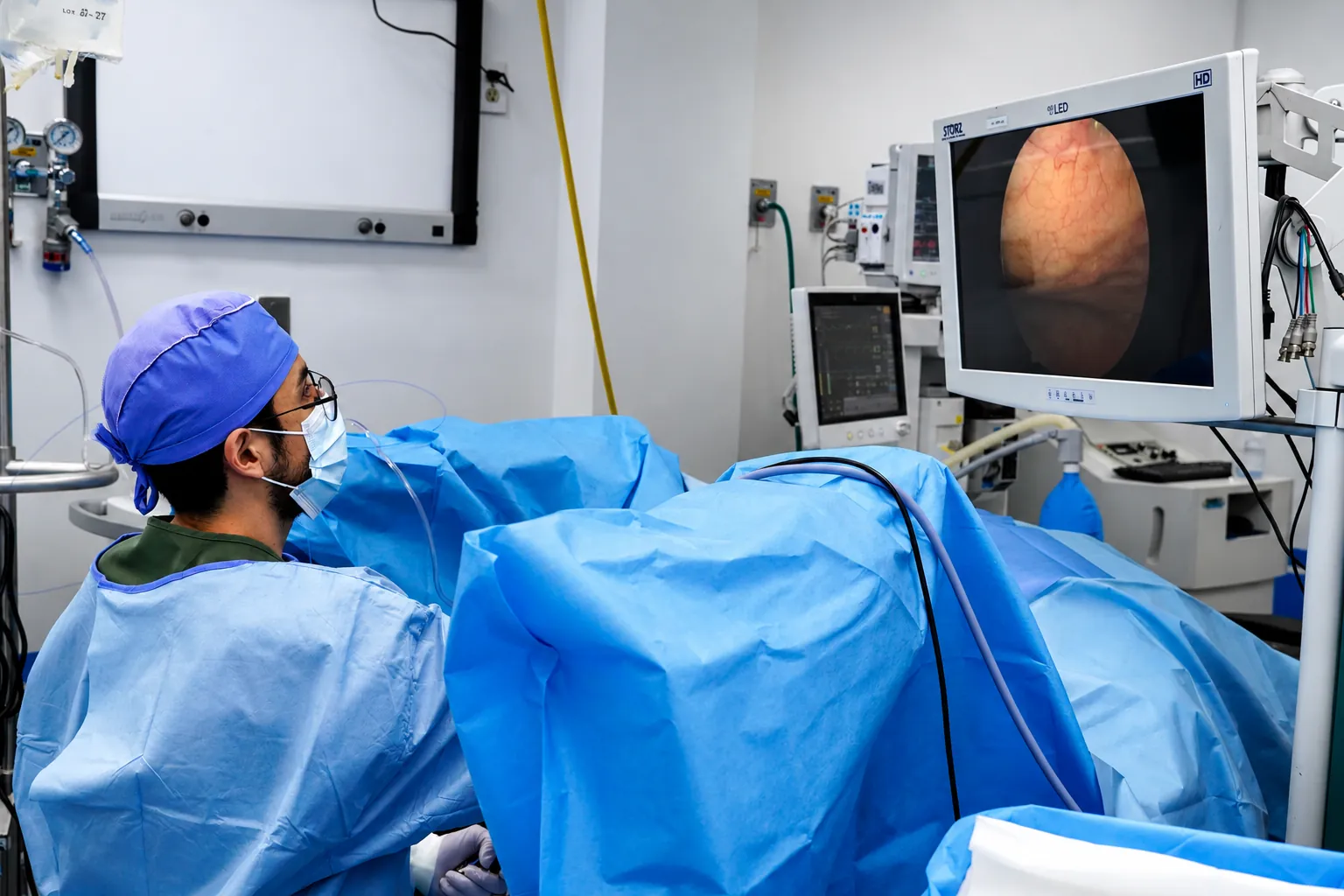 Urólogo operando con el monitor endoscópico al fondo durante un HoLEP
