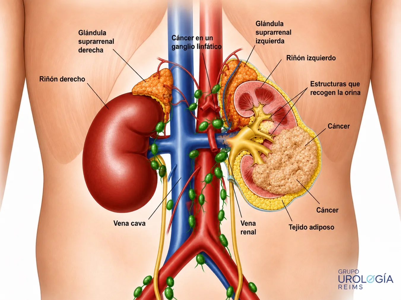 Recordatorio anatómico — anatomía renal