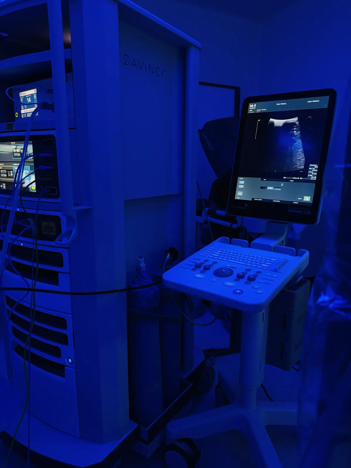 Torre de equipo con monitor de ultrasonido en el quirófano
